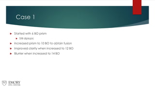 Case 1
 Started with 6 BO prism
 Still diplopic
 Increased prism to 10 BO to obtain fusion
 Improved clarity when increased to 12 BO
 Blurrier when increased to 14 BO
 