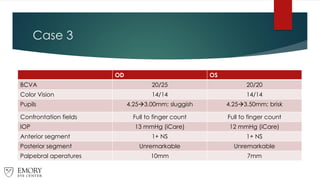 Case 3
OD OS
BCVA 20/25 20/20
Color Vision 14/14 14/14
Pupils 4.25→3.00mm; sluggish 4.25→3.50mm; brisk
Confrontation fields Full to finger count Full to finger count
IOP 13 mmHg (iCare) 12 mmHg (iCare)
Anterior segment 1+ NS 1+ NS
Posterior segment Unremarkable Unremarkable
Palpebral aperatures 10mm 7mm
 