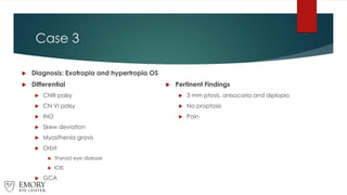 Case 3
 Diagnosis: Exotropia and hypertropia OS
 Differential
 CNIII palsy
 CN VI palsy
 INO
 Skew deviation
 Myasthenia gravis
 Orbit
 Thyroid eye disease
 IOIS
 GCA
 Pertinent Findings
 3 mm ptosis, anisocoria and diplopia
 No proptosis
 Pain
 