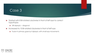 Case 3
 Started with 8 BI rotated clockwise in front of left eye to correct
hypotropia
 Still diplopic – diagonal
 Increased to 10 BI rotated clockwise in front of left eye
 Fusion in primary gaze but diplopic with small eye movements
 