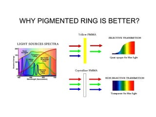 WHY PIGMENTED RING IS BETTER?
LIGHT SOURCES SPECTRA
 