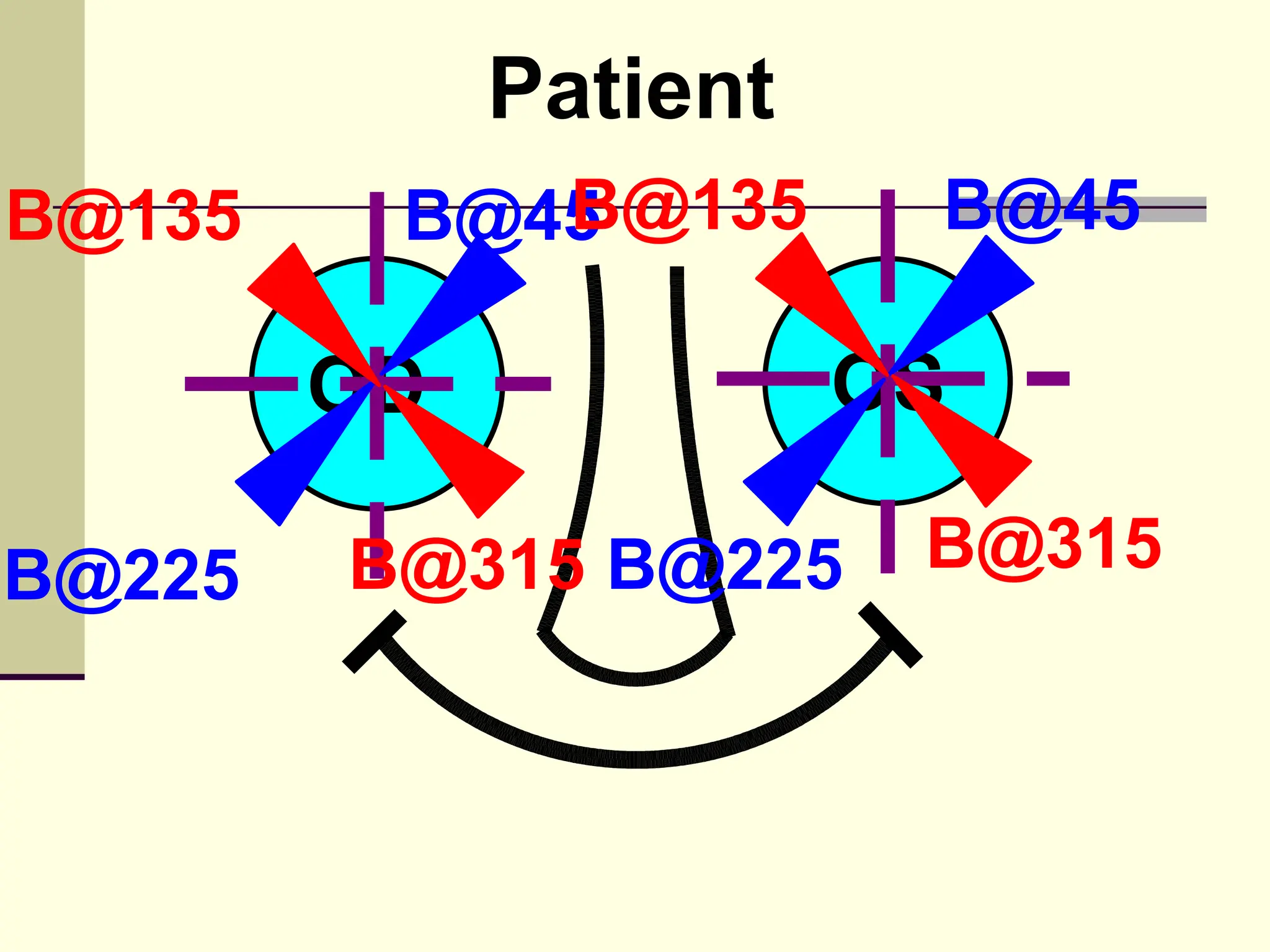 Patient
B@135       B@135
         B@45           B@45

        OD             OS

B@225   B@315 B@225     B@315
 