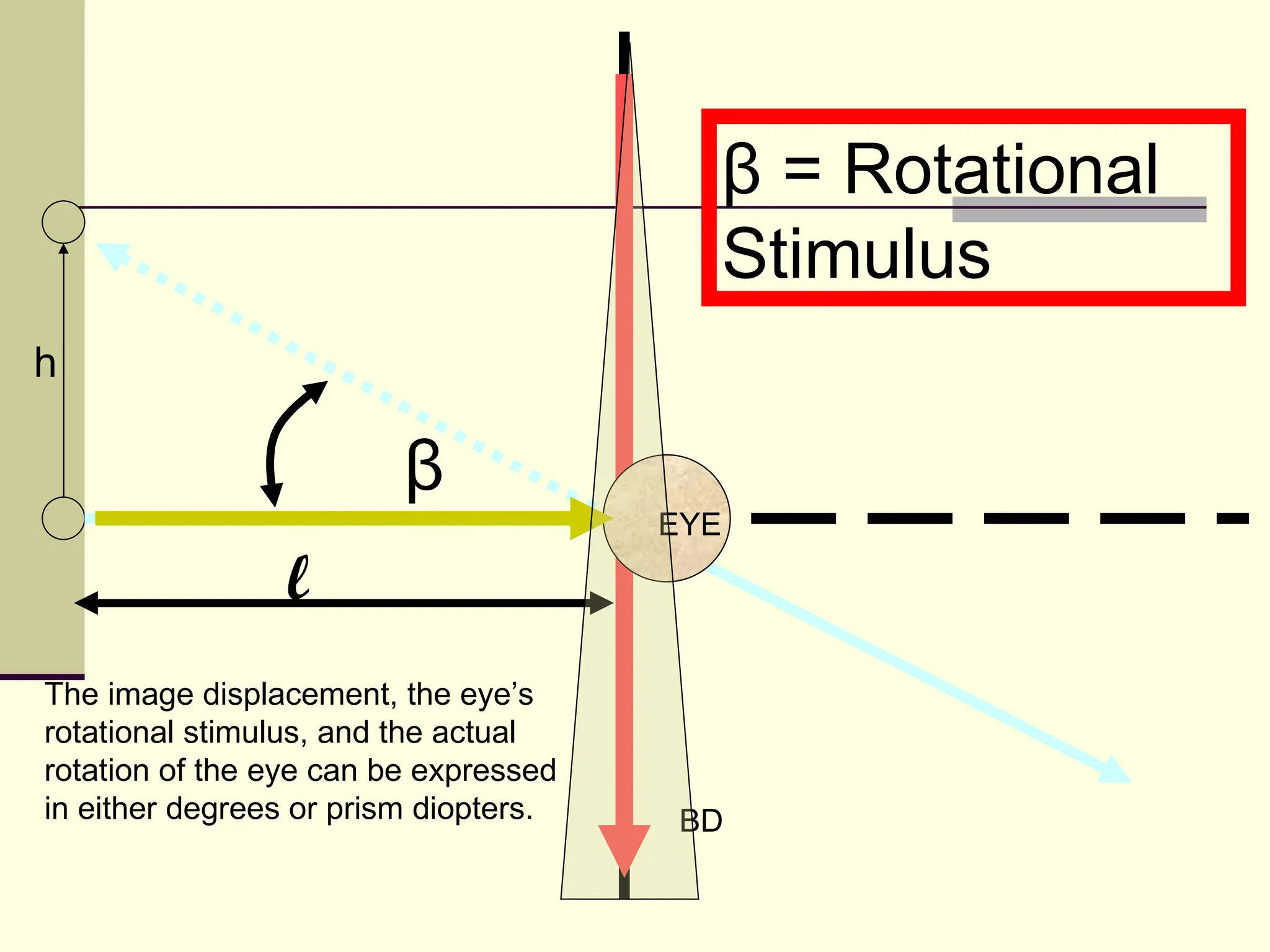 β = Rotational
                                             Stimulus
h

                         β
                                       EYE

                 l
The image displacement, the eye’s
rotational stimulus, and the actual
rotation of the eye can be expressed
in either degrees or prism diopters.    BD
 