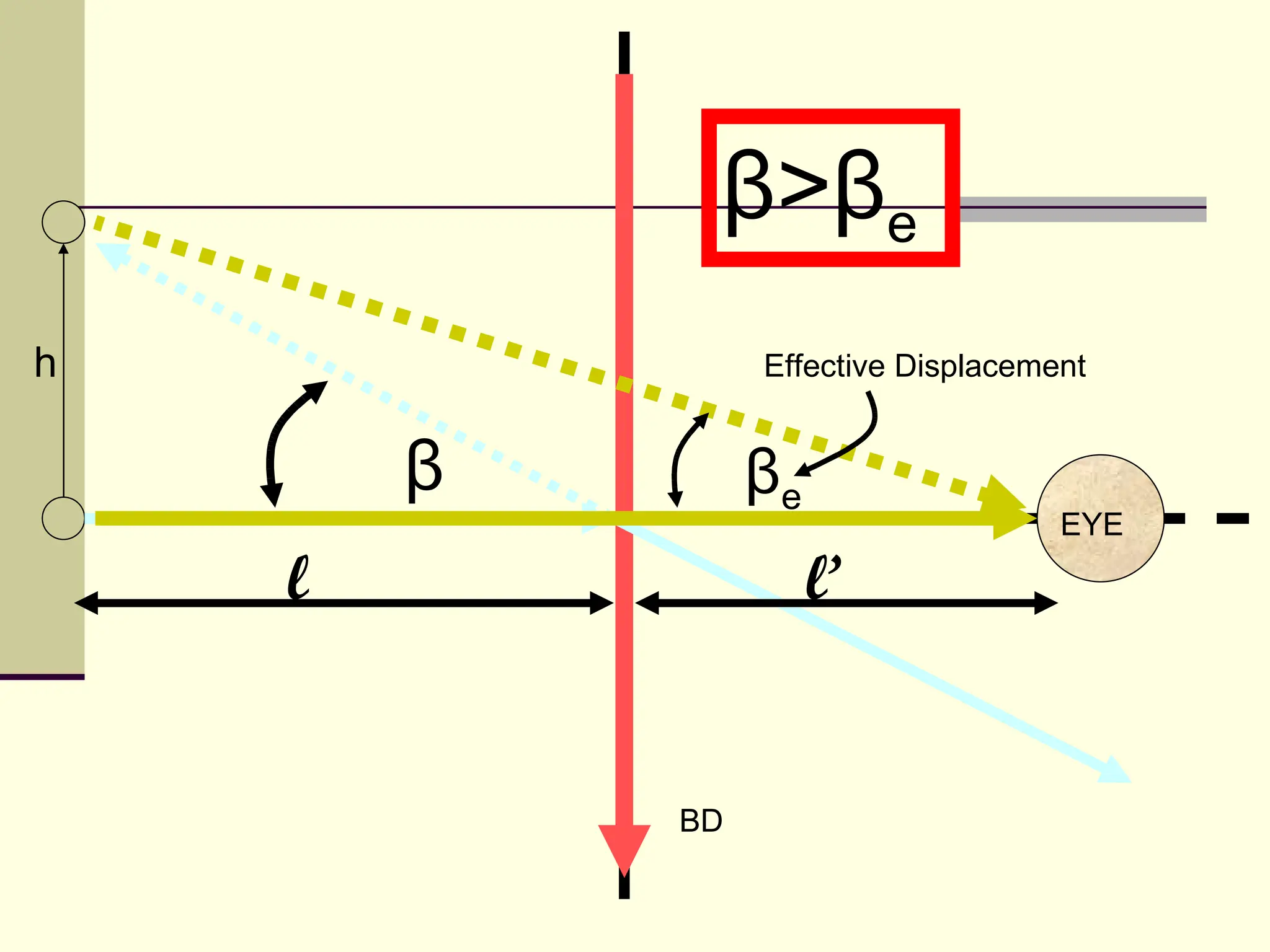 β>βe
h                Effective Displacement


        β        βe
                                     EYE

    l                 l’


            BD
 