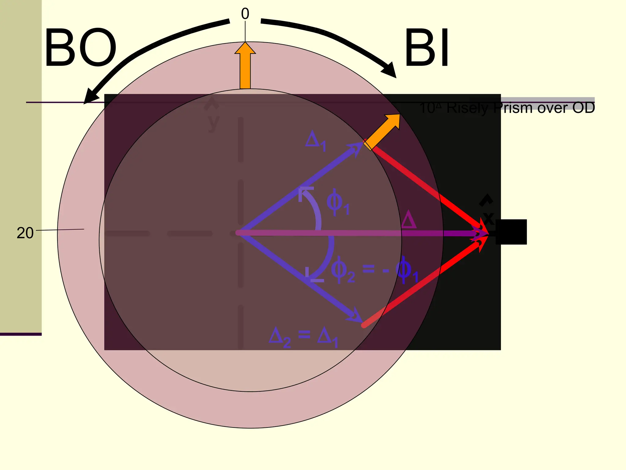 0

     BO                          BI
                                     10Δ Risely Prism over OD
          y
                     ∆1

                       φ1
20
                                 ∆           x
                                                 20

                          φ2 = - φ1

                  ∆2 = ∆1
 