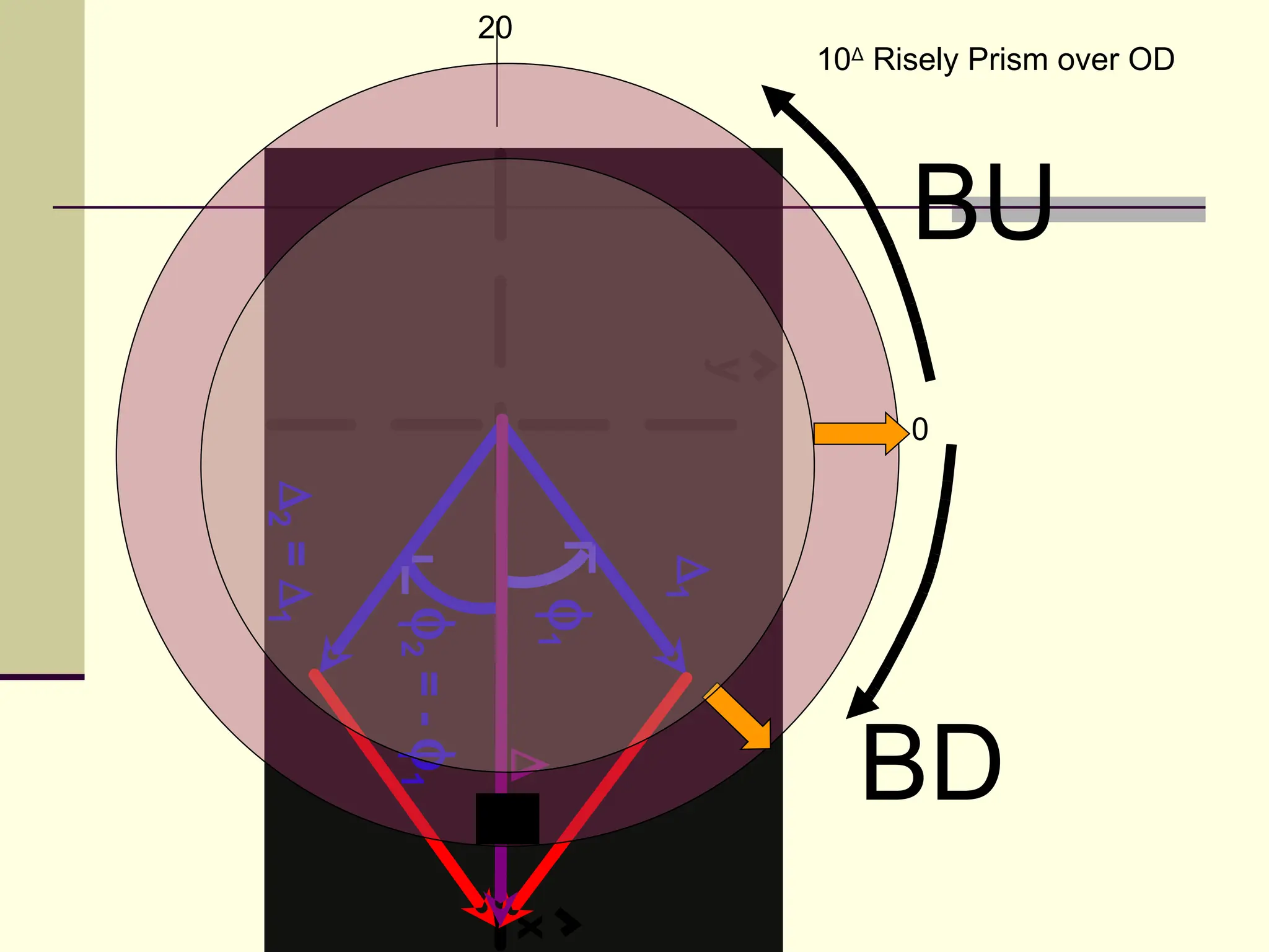 20
                                    10Δ Risely Prism over OD




                                          BU



                                y
                                          0
∆2 = ∆1




                               ∆1
                           φ
          φ2 = - φ1

                           1




                                      BD
                       ∆




                      20
                       x
 