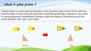 What is yoke prism ?
Yoked prisms is a term used to describe a pair of prisms (one in front of the right eye
and the other in front of the left eye) either used therapeutically in glasses or as a tool
in neuro-optometric rehabilitation therapy, where the bases of the prisms are in the
same direction: left, right, up or down.
Before After
 