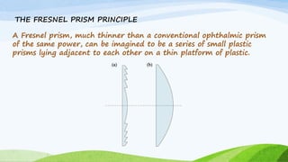 THE FRESNEL PRISM PRINCIPLE
A Fresnel prism, much thinner than a conventional ophthalmic prism
of the same power, can be imagined to be a series of small plastic
prisms lying adjacent to each other on a thin platform of plastic.
 