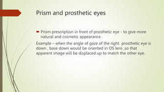 Prism and prosthetic eyes
 Prism prescription in front of prosthetic eye - to give more
natural and cosmetic appearance .
Example – when the angle of gaze of the right prosthetic eye is
down , base down would be oriented in OS lens ,so that
apparent image will be displaced up to match the other eye.
 