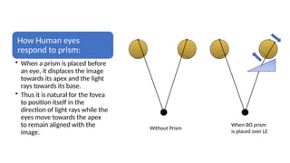 Prism Base Direction Examples Eye Prism and Its Uses in Ophthalmic Dispensing | PPTX