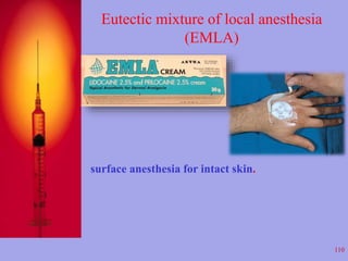 Eutectic mixture of local anesthesia 
(EMLA) 
110 
surface anesthesia for intact skin. 
 