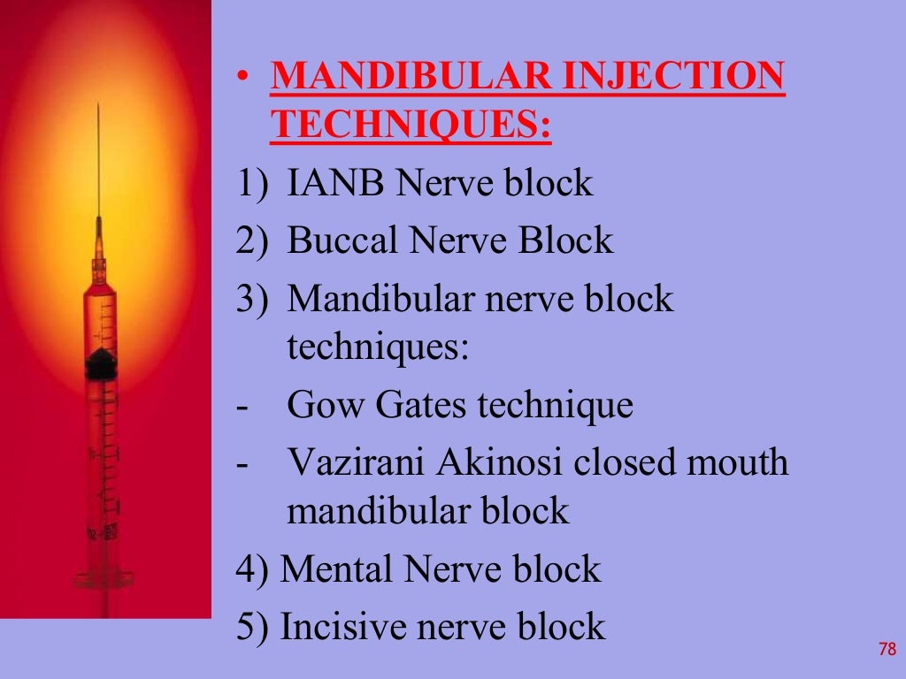 Local Anesthesia in Dentistry