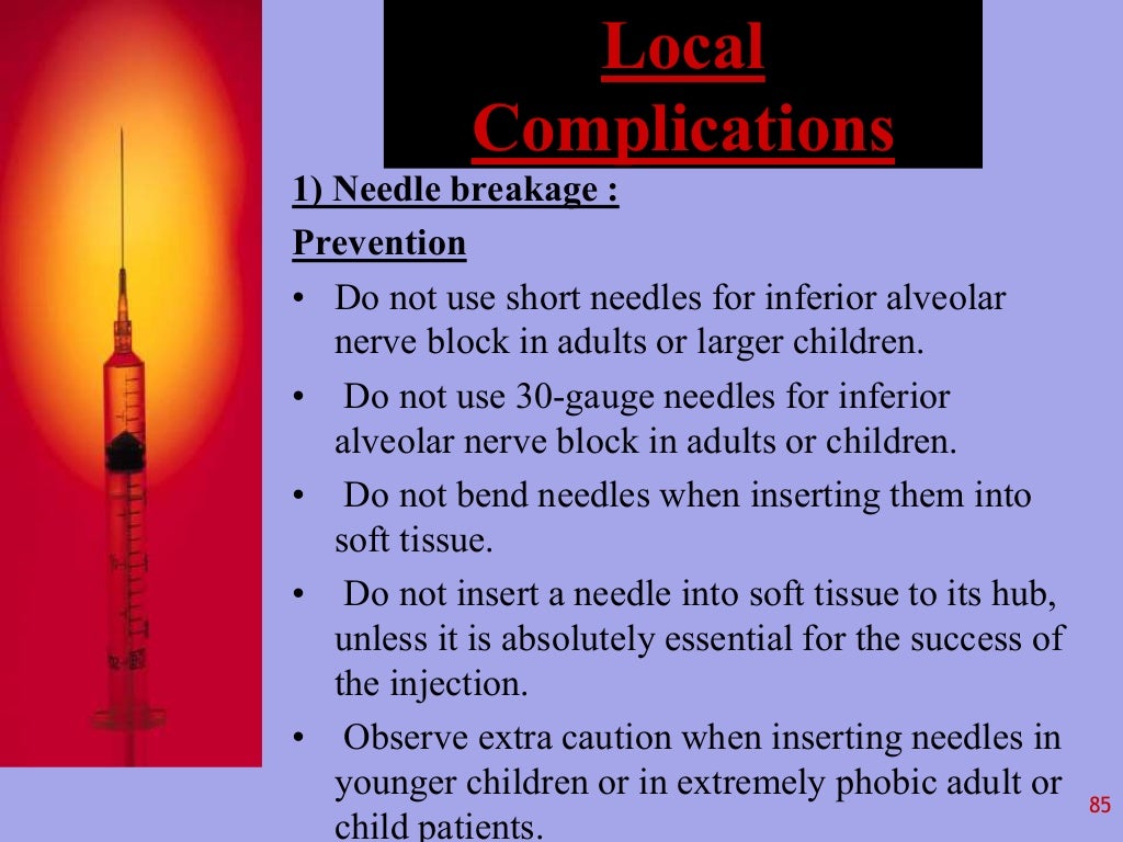 Local Anesthesia in Dentistry
