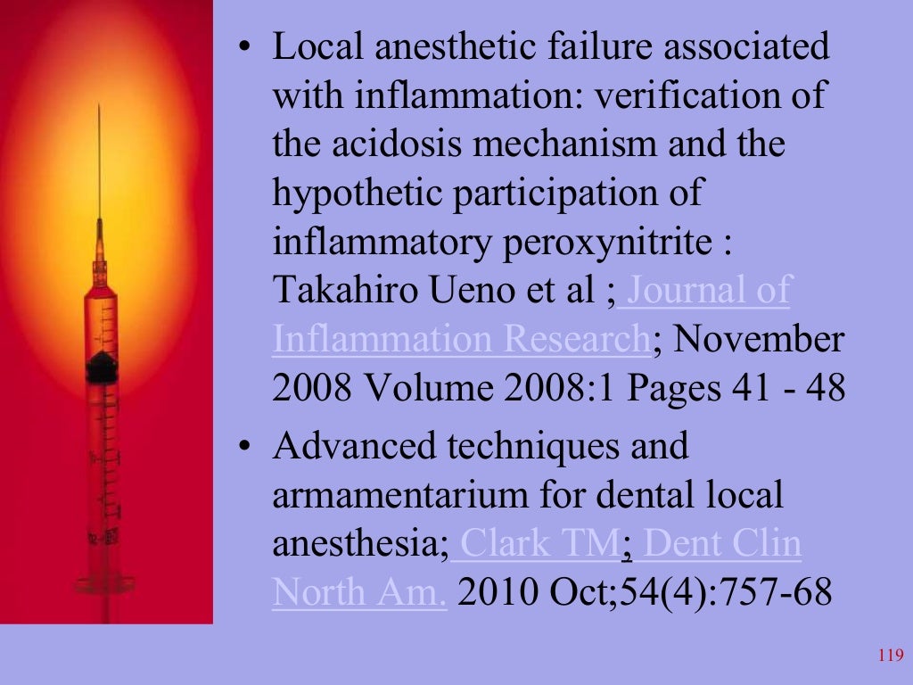 Local Anesthesia in Dentistry