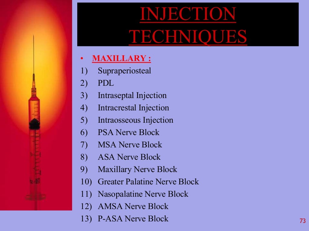 Local Anesthesia in Dentistry