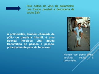 Pelo cultivo do vírus da poliomielite,
que tornou possível a descoberta da
vacina Salk
Homem com perna direita
atrofiada devido à
poliomielite.
A poliomielite, também chamada de
pólio ou paralisia infantil, é uma
doença infeciosa viral aguda
transmitida de pessoa a pessoa,
principalmente pela via fecal-oral.
 