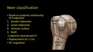 Neer classification
• Based on anatomic relationship
of 4 segments
1. Greater tuberosity
2. Lesser tuberosity
3. Articular surface
4. Shaft
a segment separate part if
• Displacement of > 1 cm
• 45° angulation
 