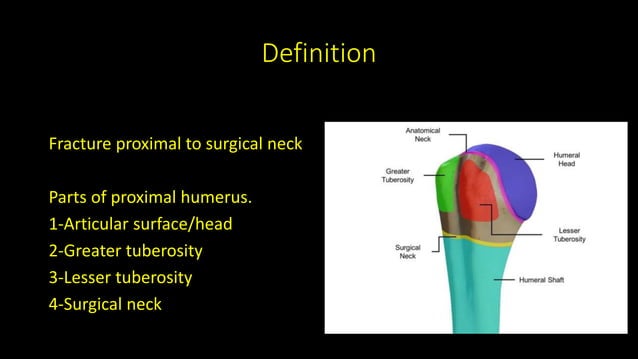 Proximal humerus fracture .pptx