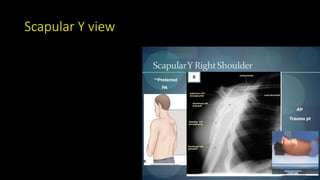 Scapular Y view
 