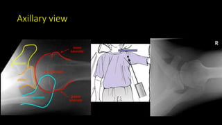 Axillary view
 