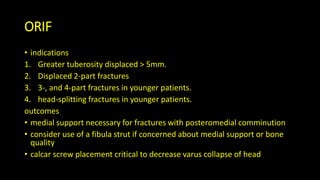 ORIF
• indications
1. Greater tuberosity displaced > 5mm.
2. Displaced 2-part fractures
3. 3-, and 4-part fractures in younger patients.
4. head-splitting fractures in younger patients.
outcomes
• medial support necessary for fractures with posteromedial comminution
• consider use of a fibula strut if concerned about medial support or bone
quality
• calcar screw placement critical to decrease varus collapse of head
 