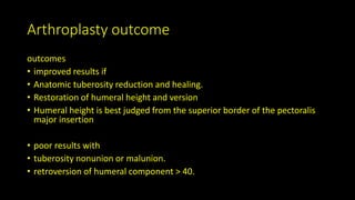 Arthroplasty outcome
outcomes
• improved results if
• Anatomic tuberosity reduction and healing.
• Restoration of humeral height and version
• Humeral height is best judged from the superior border of the pectoralis
major insertion
• poor results with
• tuberosity nonunion or malunion.
• retroversion of humeral component > 40.
 