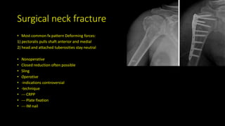 Surgical neck fracture
• Most common fx pattern Deforming forces:
1) pectoralis pulls shaft anterior and medial
2) head and attached tuberosities stay neutral
• Nonoperative
• Closed reduction often possible
• Sling
• Operative
• -indications controversial
• -technique
• --- CRPP
• --- Plate fixation
• --- IM nail
 