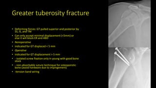 Greater tuberosity fracture
• Deforming forces: GT pulled superior and posterior by
SS, IS, and TM
• Can only accept minimal displacement (<5mm) or
else it will block ER and ABD
• Nonoperative
• indicated for GT displaced < 5 mm
• Operative
• indicated for GT displacement > 5 mm
• - isolated screw fixation only in young with good bone
stock
• - non-absorbable suture technique for osteoporotic
bone (avoid hardware due to impingement)
• -tension band wiring
 