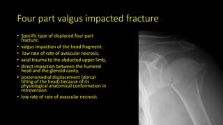 Four part valgus impacted fracture
• Specific type of displaced four-part
fracture.
• valgus impaction of the head fragment.
• low rate of rate of avascular necrosis.
• axial trauma to the abducted upper limb,
• direct impaction between the humeral
head and the glenoid cavity.
• posteromedial displacement (dorsal
tilting of the head) because of its
physiological anatomical conformation in
retroversion.
• low rate of rate of avascular necrosis
 