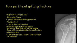 Four part head splitting fracture
• High risk of AVN (21-75%)
• Deforming forces:
• 1) shaft pulled medially by pectoralis
• Young patient
• ORIF vs. hemiarthroplasty
• hemiarthroplasty favored for non-
reconstructible articular surface, severe
head split, extruded anatomic neck fracture.
• Elderly patient
• -Hemiarthroplasty v. reverse total shoulder
arthroplasty
 