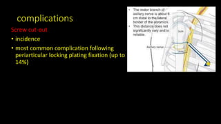 complications
Screw cut-out
• incidence
• most common complication following
periarticular locking plating fixation (up to
14%)
 