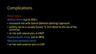 Complications
Nerve injury
Axillary nerve (up to 58% )
• increased risk with lateral (deltoid-splitting) approach
• axillary nerve is usually found ~5-7cm distal to the tip of the
acromion
• at risk with lateral pins in CRPP
Suprascapular nerve (up to 48%)
Musculocutaneous nerve
• at risk with anterior pins in CRP
 