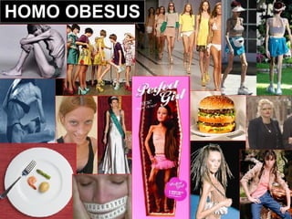 HOMO OBESUS 