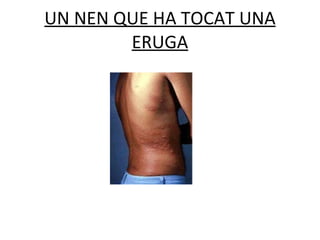 UN NEN QUE HA TOCAT UNA ERUGA