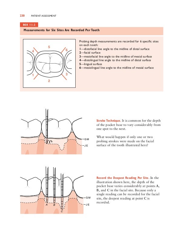 Dental Pocket Depth Chart