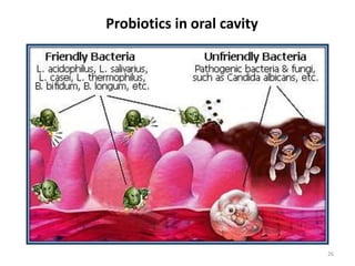 Probiotics in oral cavity
26
 