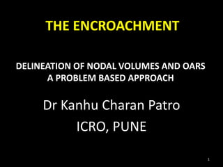 DELINEATION OF NODAL VOLUMES AND OARS
A PROBLEM BASED APPROACH
Dr Kanhu Charan Patro
ICRO, PUNE
1
THE ENCROACHMENT
 