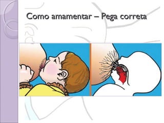 Como amamentar – Pega correta

 