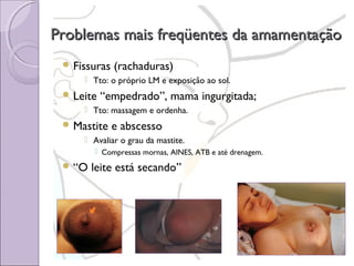 Problemas mais freqüentes da amamentação
 Fissuras

(rachaduras)

 Tto: o próprio LM e exposição ao sol.

 Leite

“empedrado”, mama ingurgitada;

 Tto: massagem e ordenha.

 Mastite

e abscesso

 Avaliar o grau da mastite.
 Compressas mornas, AINES, ATB e até drenagem.

 “O

leite está secando”

 