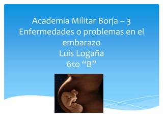 Academia Militar Borja – 3
Enfermedades o problemas en el
          embarazo
         Luis Logaña
           6to “B”
 