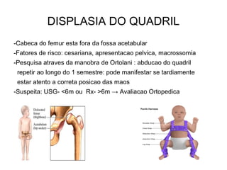 DISPLASIA DO QUADRIL
-Cabeca do femur esta fora da fossa acetabular
-Fatores de risco: cesariana, apresentacao pelvica, macrossomia
-Pesquisa atraves da manobra de Ortolani : abducao do quadril
repetir ao longo do 1 semestre: pode manifestar se tardiamente
estar atento a correta posicao das maos
-Suspeita: USG- <6m ou Rx- >6m → Avaliacao Ortopedica
 