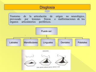 Disglosia
Trastorno de la articulación de origen no neurológico,
provocado por lesiones físicas o malformaciones de los
órganos articulatorios periféricos.
Puede ser:
Labiales Mandibulares Linguales Dentales Palatales
.
 
