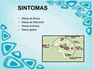 SINTOMAS
• Afasia de Broca
• Afasia de Wernicke
• Afasia anómica
• Afasia global
 