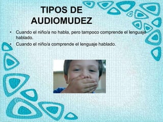 TIPOS DE
AUDIOMUDEZ
• Cuando el niño/a no habla, pero tampoco comprende el lenguaje
hablado.
• Cuando el niño/a comprende el lenguaje hablado.
 