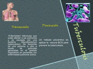 Transmisión
Enfermedad infecciosa que
suele afectar a los pulmones
y es causada por una
bacteria
(Mycobacterium
tuberculosis). Se transmite
de una persona a otra a
través
de
gotículas
generadas en el aparato
respiratorio en pacientes con
enfermedad pulmonar activa.

Prevención

Un método preventivo es
aplicar la vacuna BCG para
prevenir la tuberculosis.

 