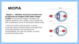 MIOPIA
Miopia é o distúrbio visual que acarreta uma
focalização da imagem antes desta chegar
à retina. Uma pessoa míope consegue ver
objetos próximos com nitidez, mas os distantes
são visualizados como se estivessem desfocados.
Para uma visão mais apurada, o ponto
focal dos raios luminosos deve convergir para
uma área próxima aos recetores de
luminosidade. No caso da miopia, o ponto
focal é formado antes.
 