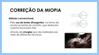 CORREÇÃO DA MIOPIA
Método convencional:
Pelo uso de lentes divergentes, na forma de
óculos ou lentes de contato, que deslocam
o ponto focal para trás;
Através de cirurgias que são realizadas por
meio de diferentes técnicas;
 