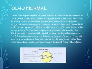 OLHO NORMAL
• O olho é um órgão complexo do corpo humano. A luz entra no olho através da
córnea, que é a membrana convexa transparente que cobre a parte anterior
do olho. A curvatura da córnea faz com que a luz refrate, ou mude sua
direção, de modo a convergir para a retina. A retina é uma película sensível à
luz localizada dentro da cavidade do olho, em sua porção posterior. Na visão
normal, o ponto focal da luz está precisamente localizada na retina. Os
distúrbios mais comuns da visão são falhas na refração (problemas com o
foco). Os problemas com a refração ocorrem quando a forma da córnea estar
incorreta, de modo que o foco dos raios de luz não estejam na retina. Isto
causa as condições conhecidas como: miopia, hipermetropia e astigmatismo.
 