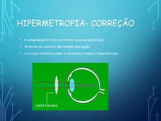 HIPERMETROPIA- CORREÇÃO
• A compensação é feita com lentes convexas (positivas).
• As lentes de contacto são também uma opção.
• A cirurgia refrativa a laser é usada para reduzir a hipermetropia.
 
