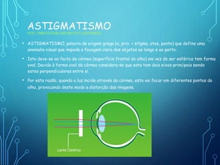 ASTIGMATISMOHTTP://WWW.YOUTUBE.COM/WATCH?V=HZR7PBE8GEK
• ASTIGMATISMO, palavra de origem grega (a, priv. + stígma, atos, ponto) que define uma
anomalia visual que impede a focagem clara dos objetos ao longe e ao perto.
• Isto deve-se ao facto da córnea (superfície frontal do olho) em vez de ser esférica tem forma
oval. Devido à forma oval da córnea considera-se que esta tem dois eixos principais sendo
estes perpendiculares entre si.
• Por esta razão, quando a luz incide através da córnea, esta vai focar em diferentes pontos do
olho, provocando deste modo a distorção das imagens.
 